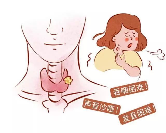 甲状腺的主要症状有哪些？甲状腺的5大主要症状讲解