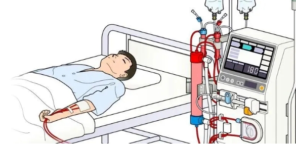 透析是什么意思啊？血液透析和尿毒症的关系
